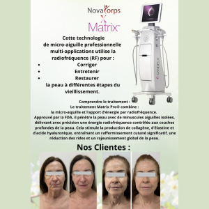 ♥️À l’achat de chaque traitement Matrix RF, obtenez gratuitement un sérum Exosomes (valeur de 220 $) Saint-Léonard